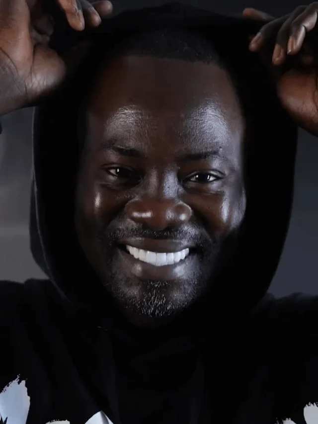 Cheikh’s Remarkable Smile Transformation in Turkey