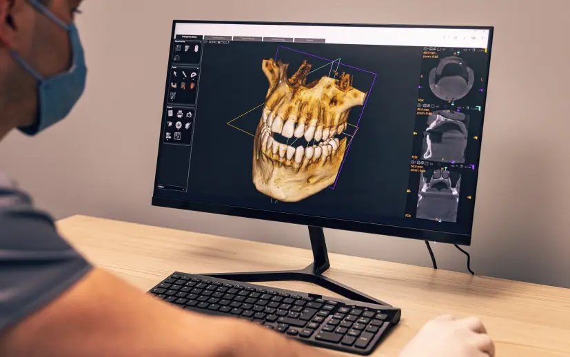 What is 3D Dental Tomography (CBCT)?