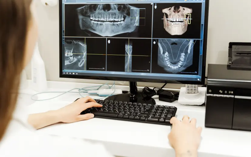 3D Dental Tomography (CBCT) | Fast, Safe, and Comfortable Imaging